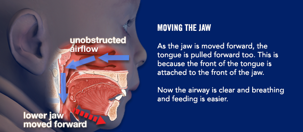 Moving the jaw