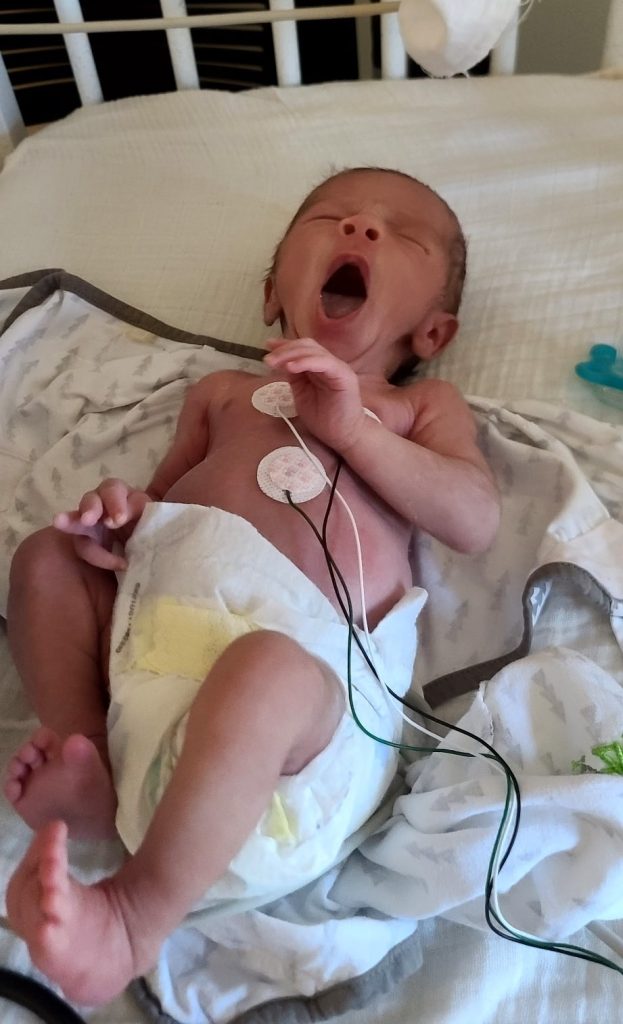 A'zarion yawning while in crib at the hospital with monitoring cords on his chest.