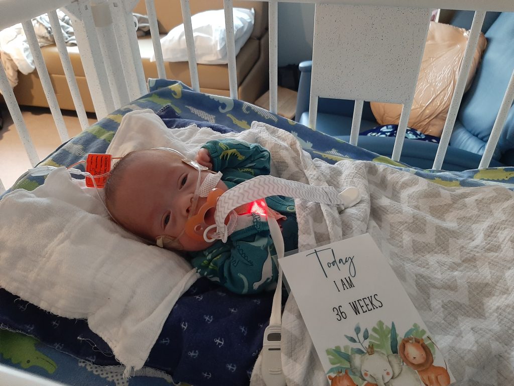 Carlisle in the hospital after being born