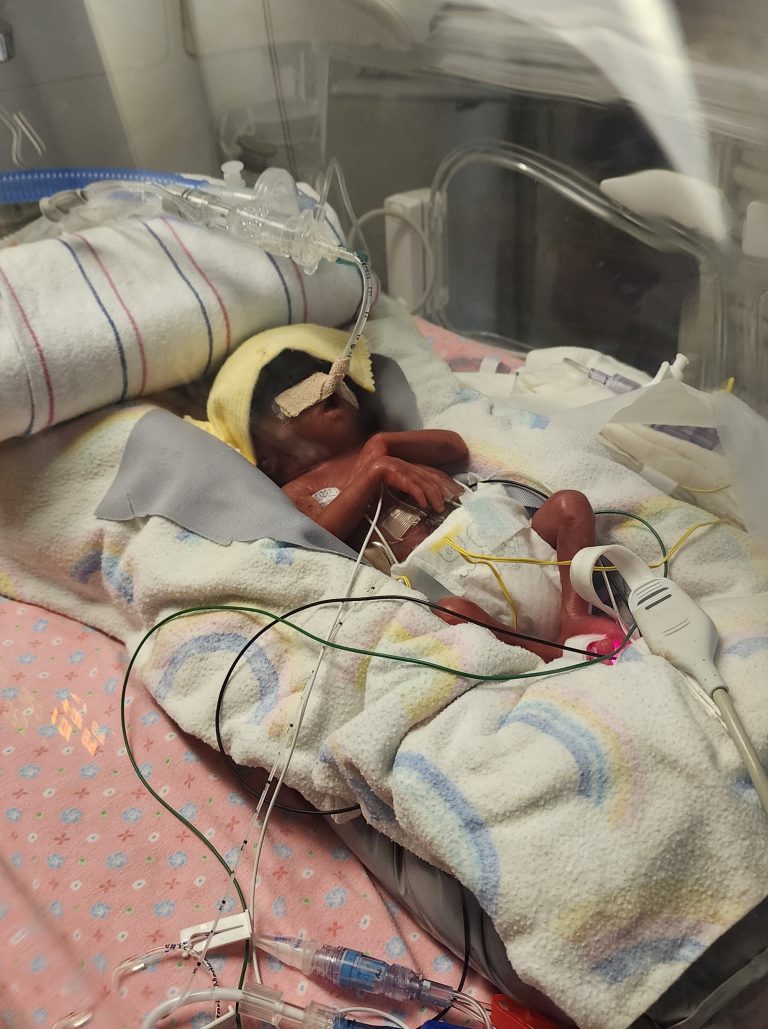 Gracelyn in the incubator in the NICU at Children's Minnesota.