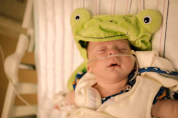 NICU baby dressed up as a frog for Halloween