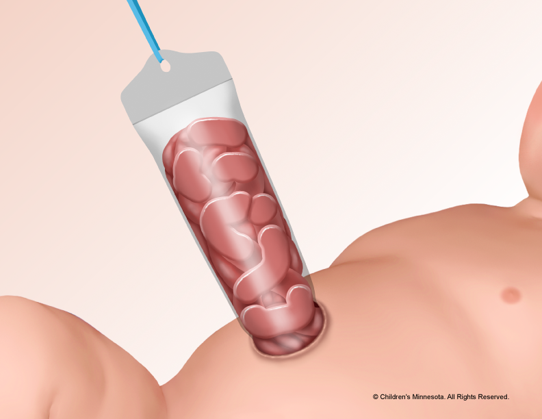 illustration showing the external organs contained into a tube that is connected to the stomach of the newborn