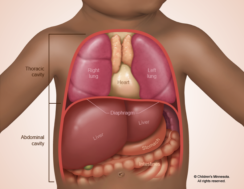 Normal anatomy, with diaphragm separating thoracic cavity from abdomen