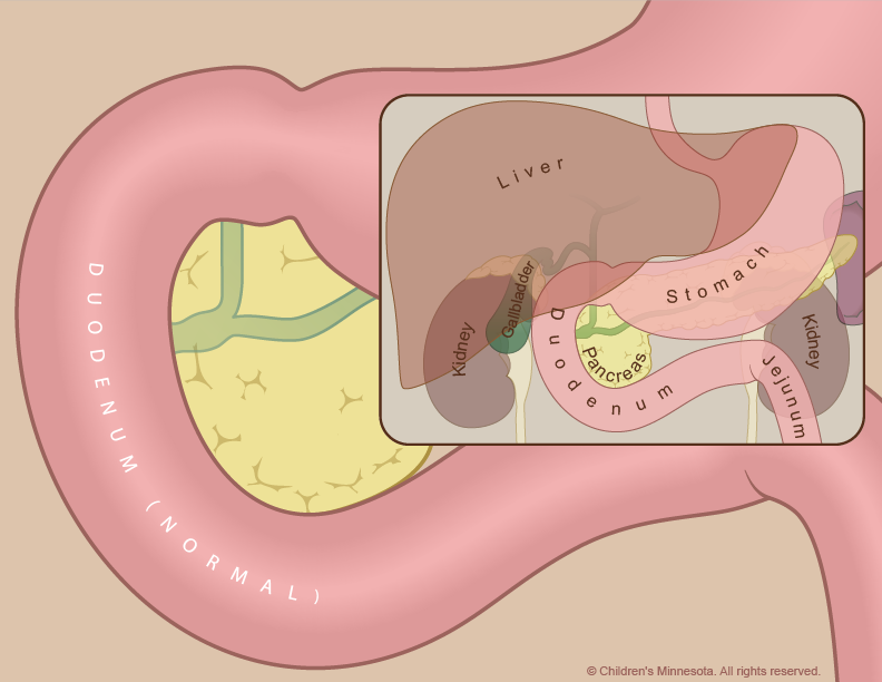 Figure 1 - Normal upper intestinal anatomy