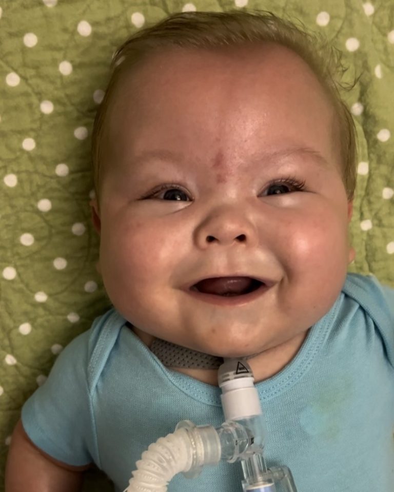 Clifford with trach
