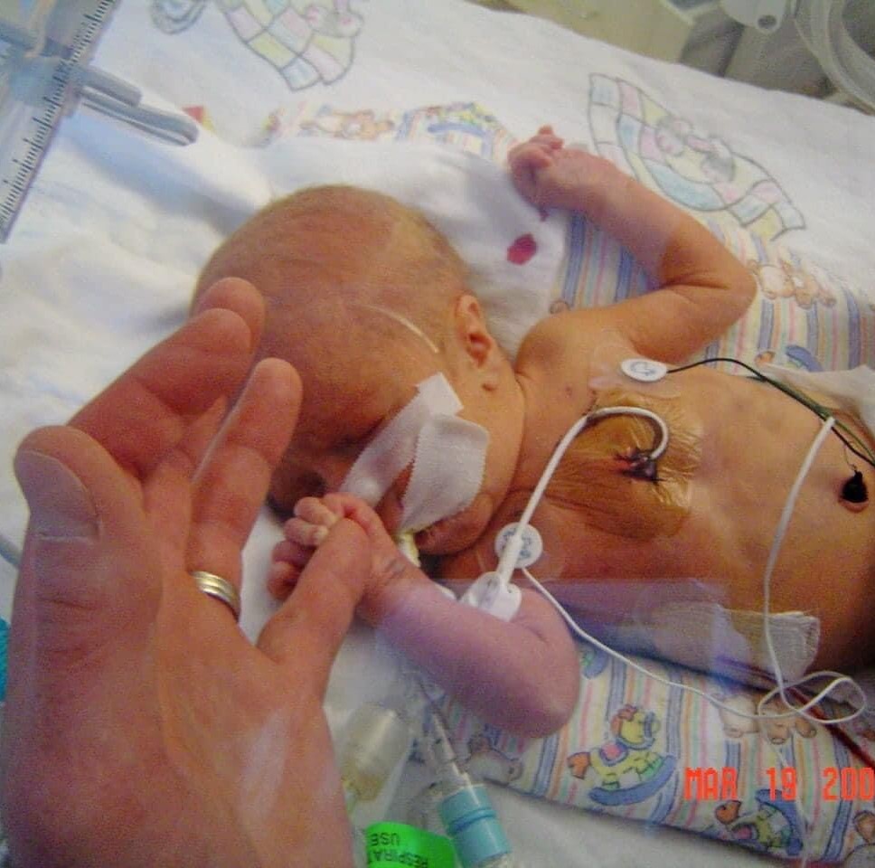 Brady as an infant in the hospital