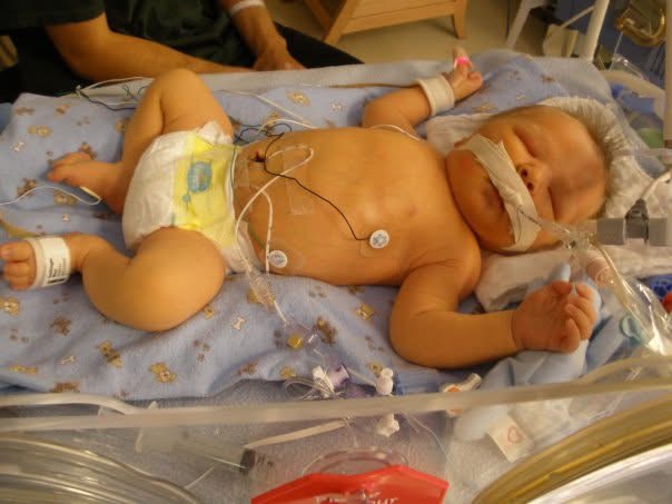 Braedyn as a baby in a hospital crib