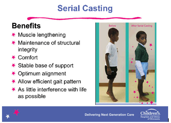 carespecialties.rehab.serialcasting