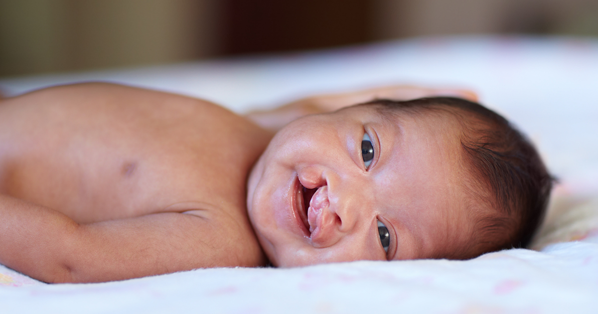 Children’s Minnesota becomes first health system in the state to offer innovative new cleft lip treatment for babies