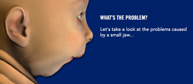 What's the problem? Let's take a look at the problems caused by a small jaw...