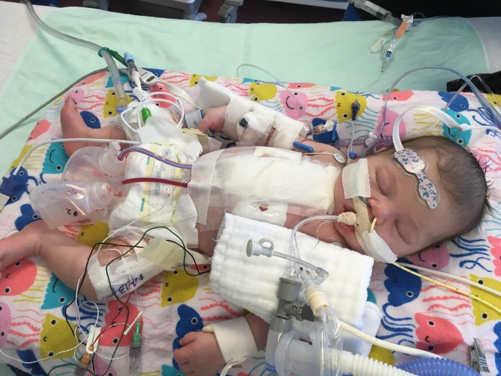 Delilah in the hospital after being born hooked up to many tubes
