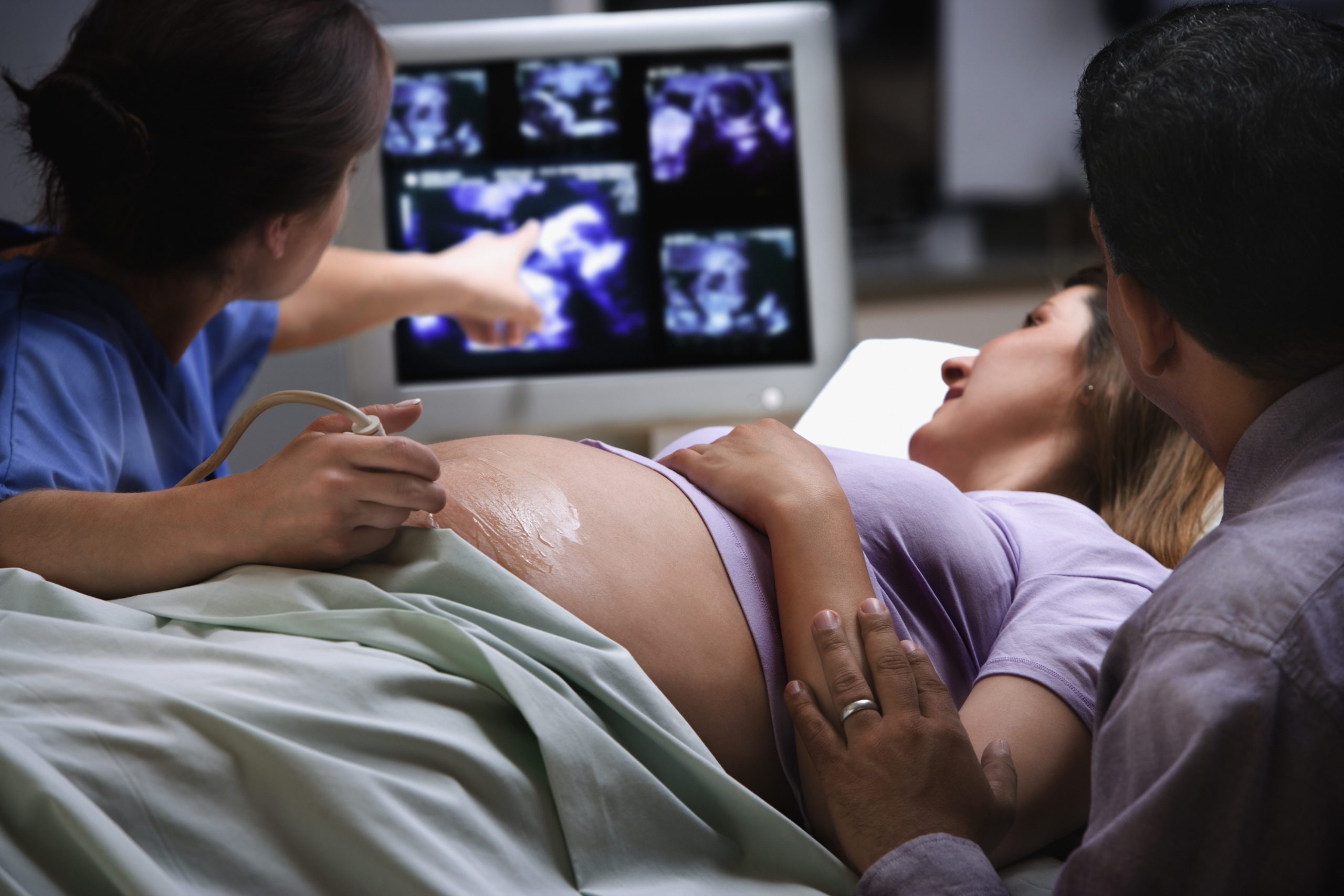 a woman receives an ultrasound on her belly