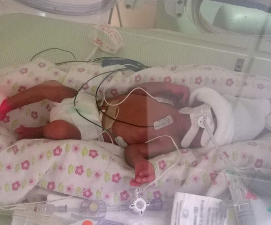 Premature baby in the NICU