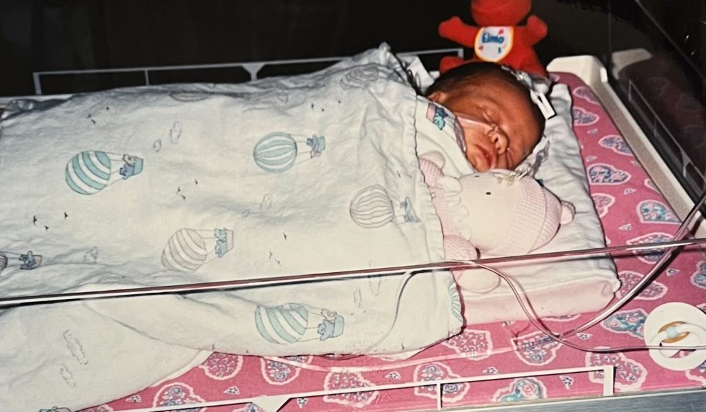 Calista in the hospital shortly after being born