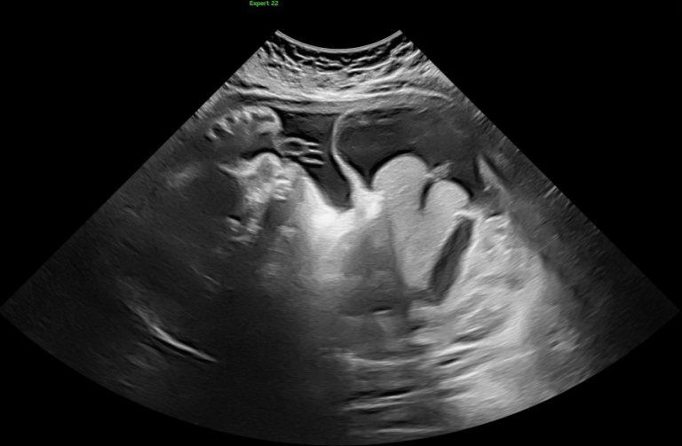 Ultrasound of Hallie.