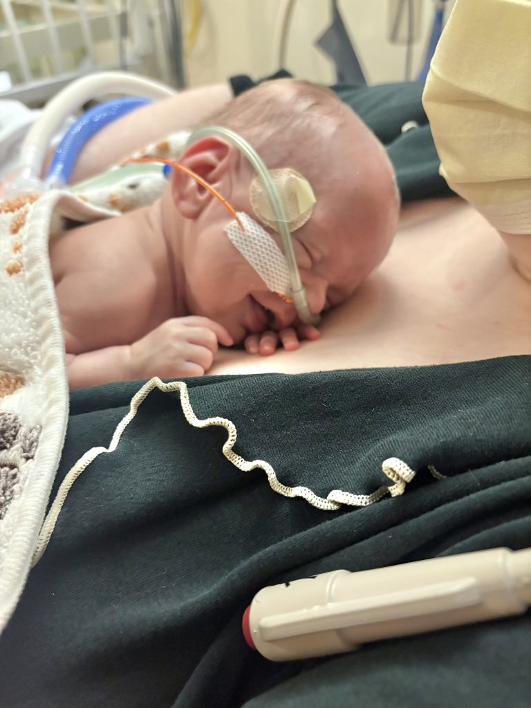 Baby Rendalisa rests on her mom's chest in the NICU.