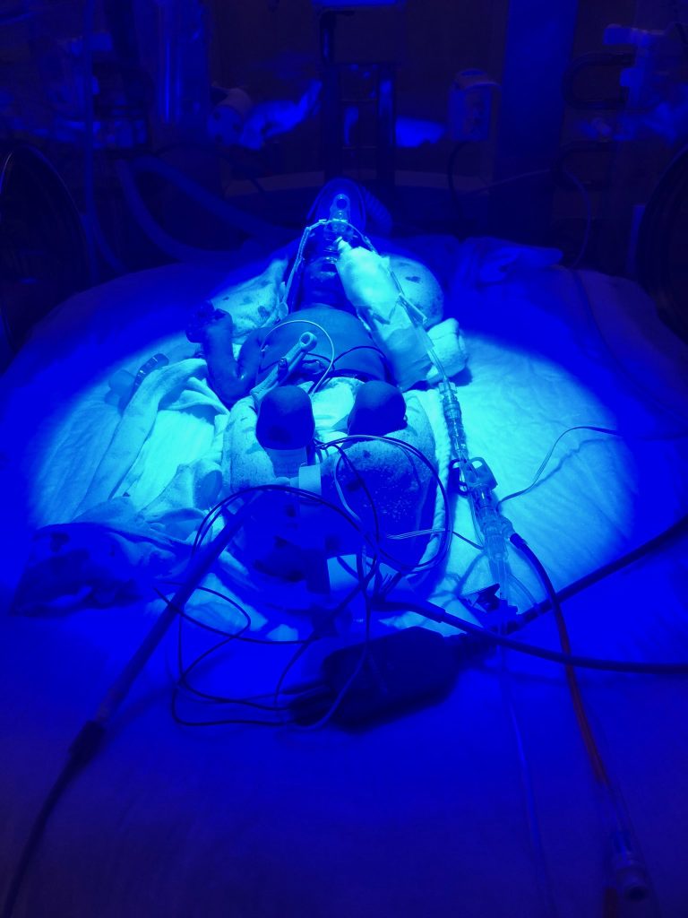 Photo in NICU