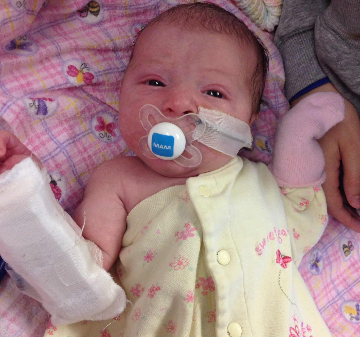 Elsie in the hospital as a baby