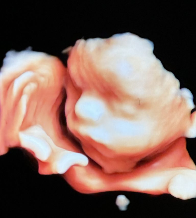 Scan of baby Santiago