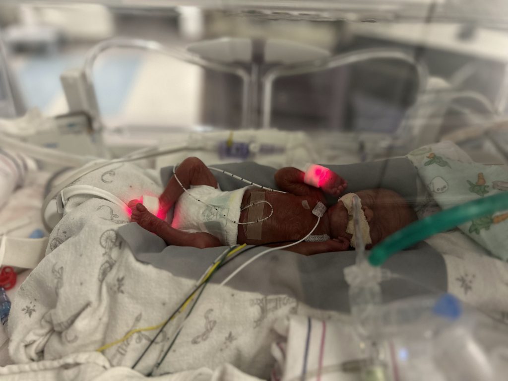 Baby Myah as a newborn in her NICU bed.