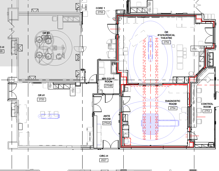 Image of the iMRI layout