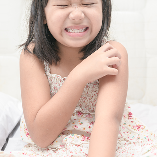 young Asian girl itching skin