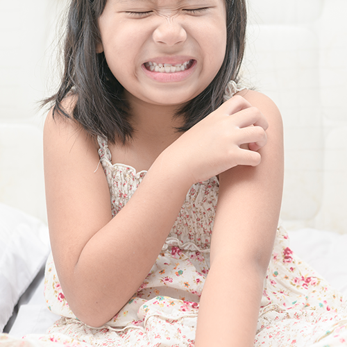 itch_FB young Asian girl itching skin