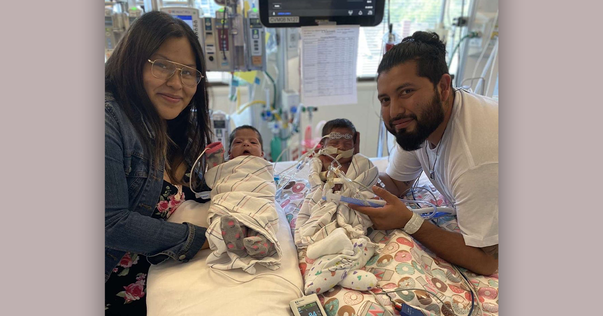 Twins Sol and Luna born with the same congenital heart defect