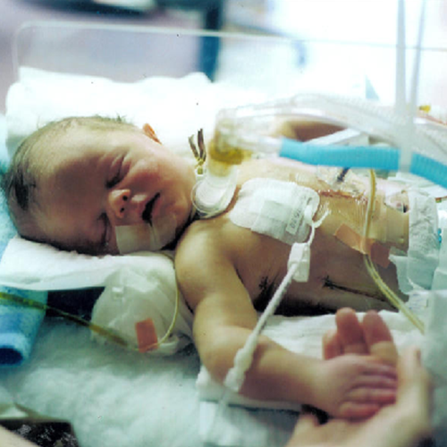 Markus when he was a baby in the hospital.