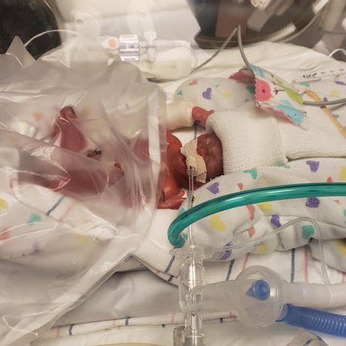 Baby Richard in NICU