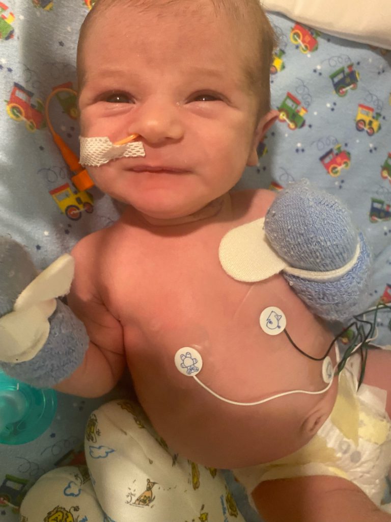 Baby murphy during swallow study