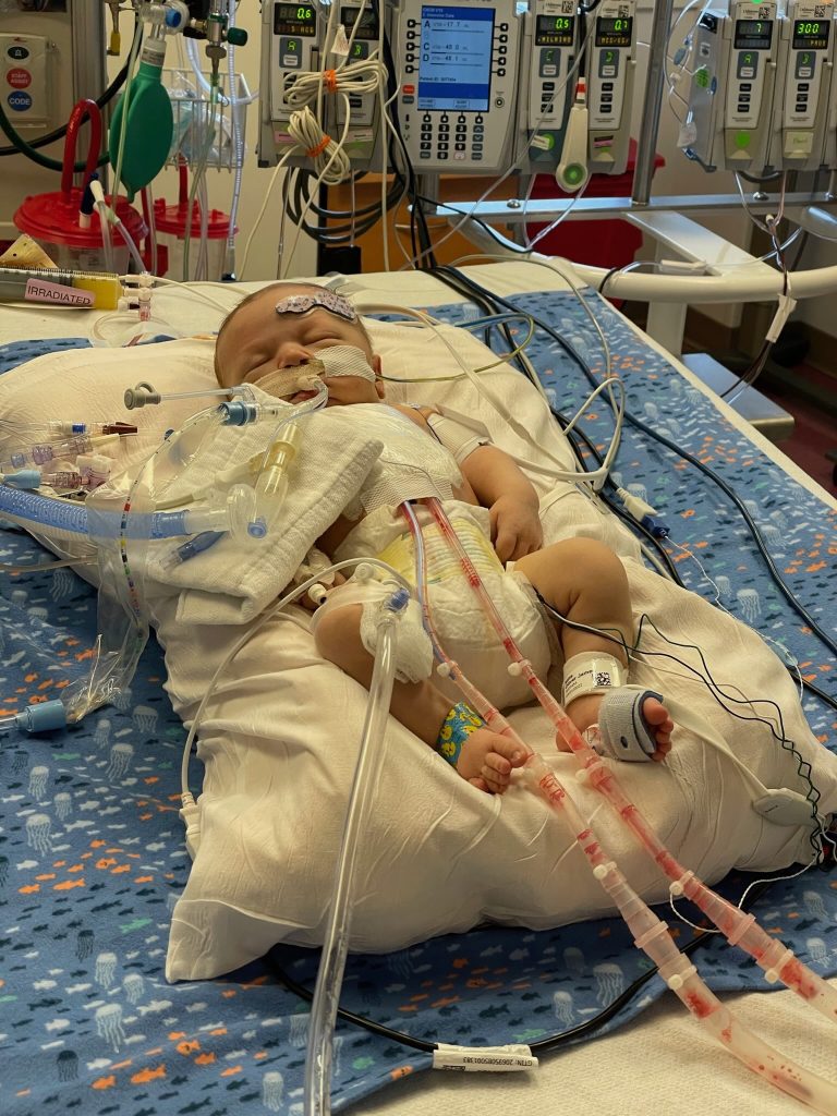 Ollie as a baby in the hospital