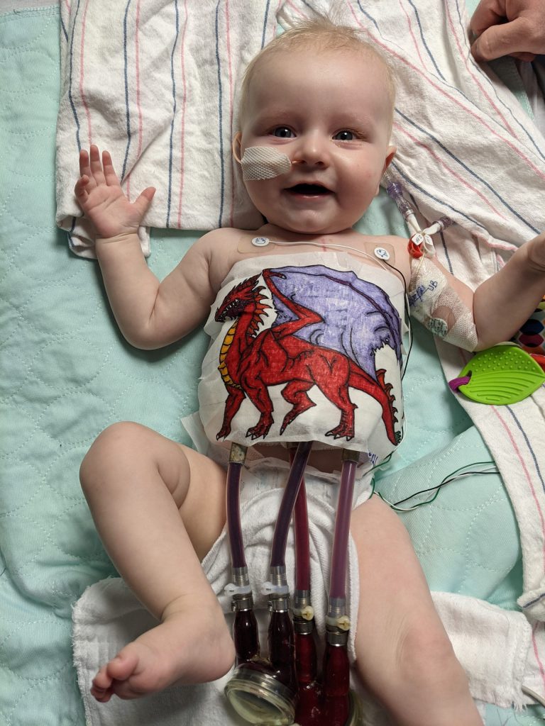 Baby Ozzie in hospital bed