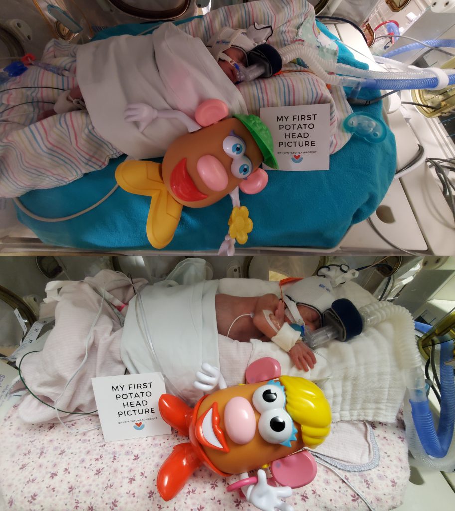 Peyton, top, Madison, bottom, at 9 days old, in the hospital