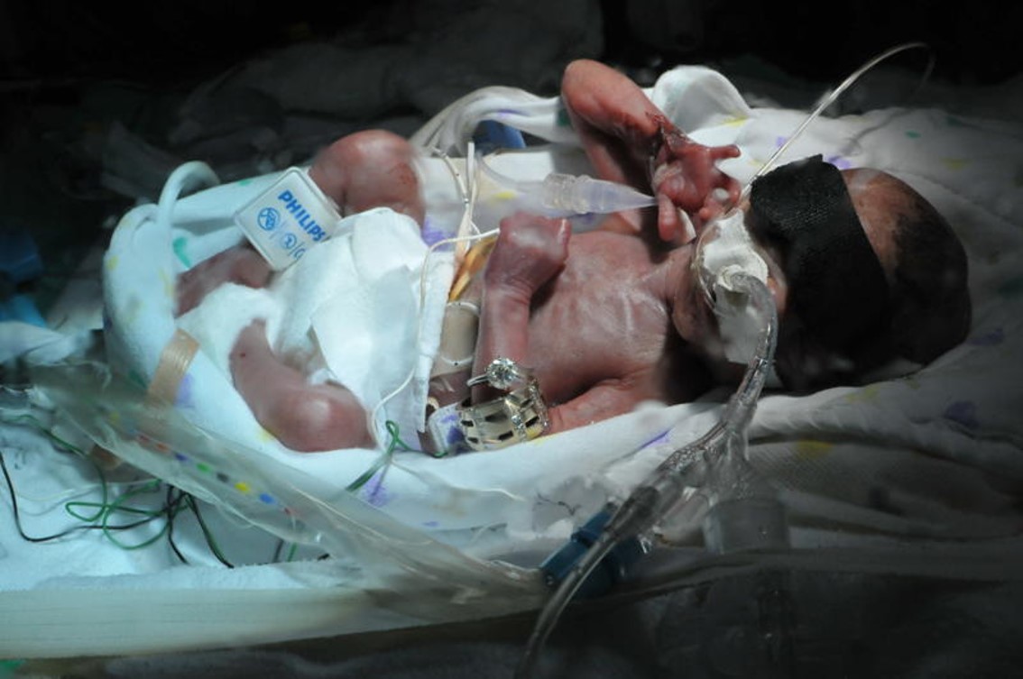 Shelby in the NICU