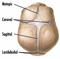 An image of a skull displaying different Craniosynostosis Sutures