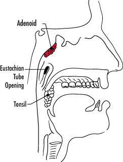 surg_adenoid