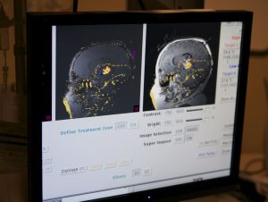 Medical imaging of a child's brain