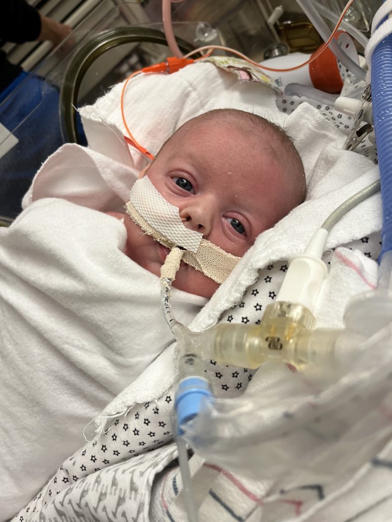 Baby Bennett during his stay in the NICU.