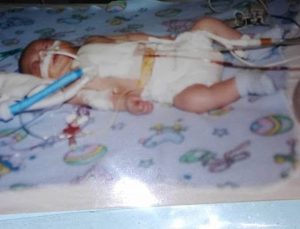 Photo of Trever as an infant and hooked up to medical equipment for his heart condition.