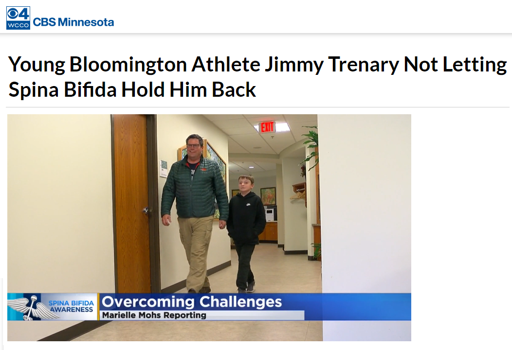 Screen grab of WCCO story about Jimmy