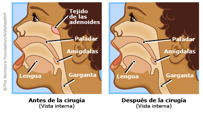 ilustracion ilustracion