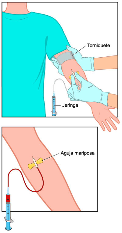 análisis de sangre