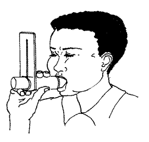 How To Read Peak Flow Meter Chart