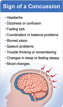 Sign of a concussion