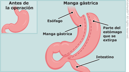 Manga gastrica