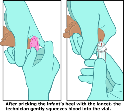 heel_prick_illustration