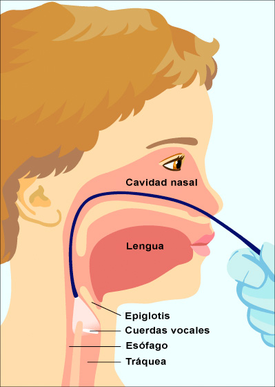 laringoscopia