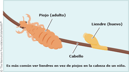 Piojos, liendres y tratamientos - Farmacia El Negrito