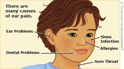 otalgia illustration